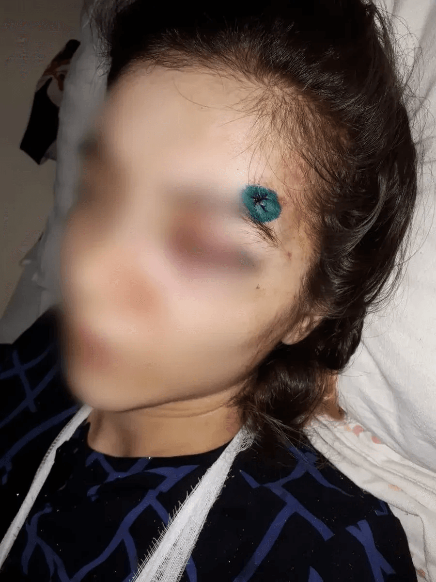 Гулли после избиения